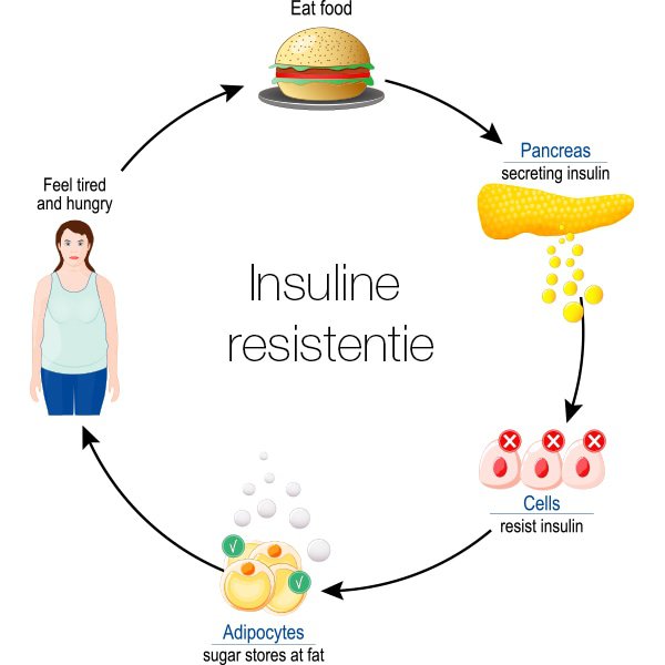 insuline resistentie